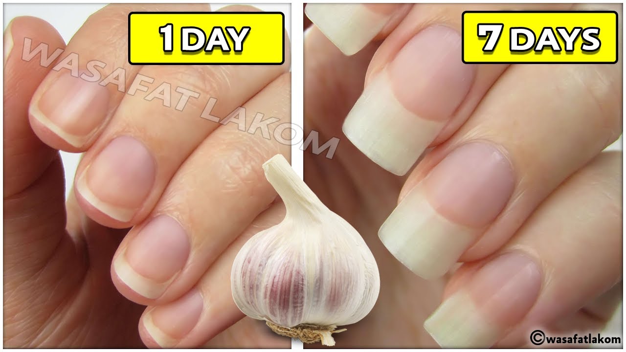 How to grow nails with garlic in just a week.