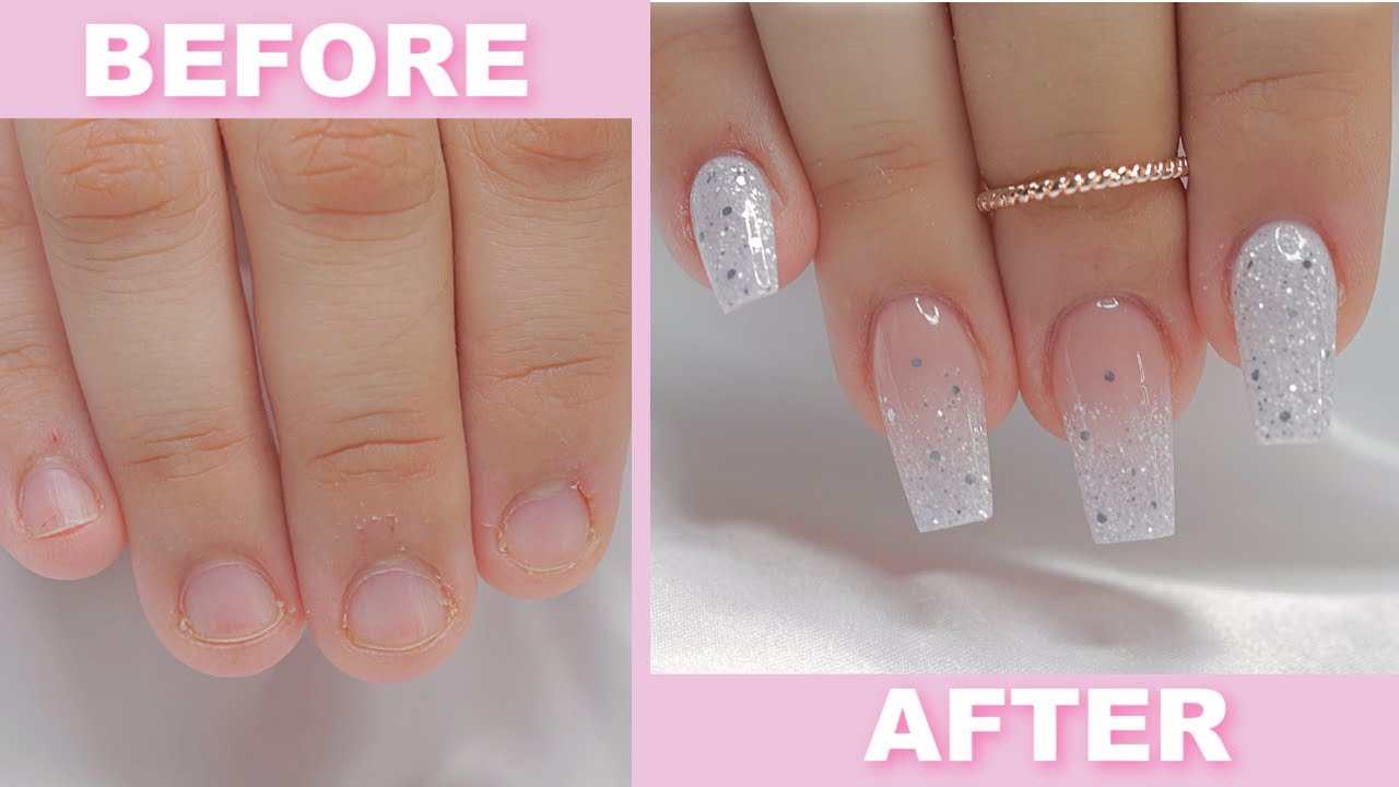 EXTREME Transformation! From BITTEN to GORGEOUS Nails