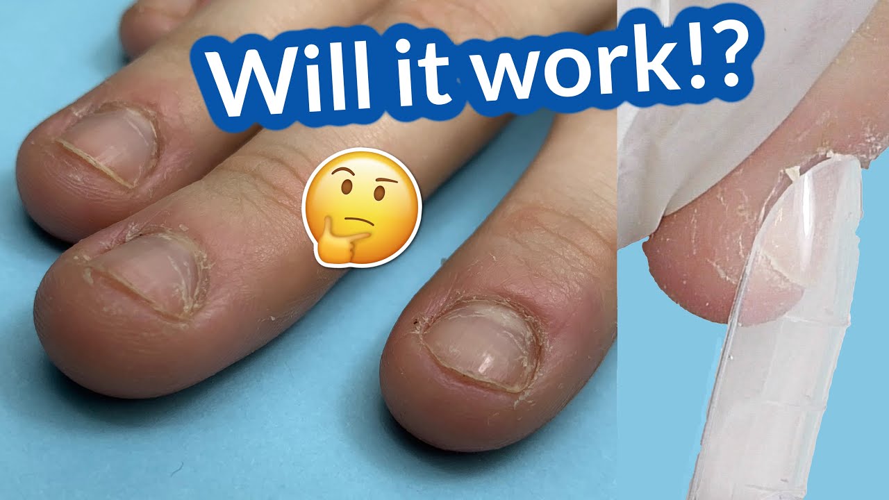 Dual Forms & Polygel for BITTEN NAILS – Will it work? Anna Nails Transformation