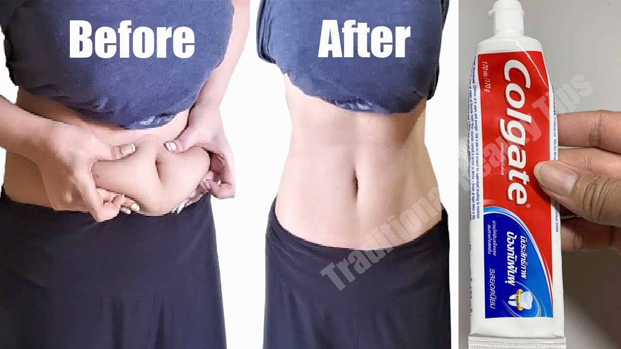 Just Apply it Before Bedtime & Burn Fat Overnight, In 3 Days Loss Your Weight Super Fast