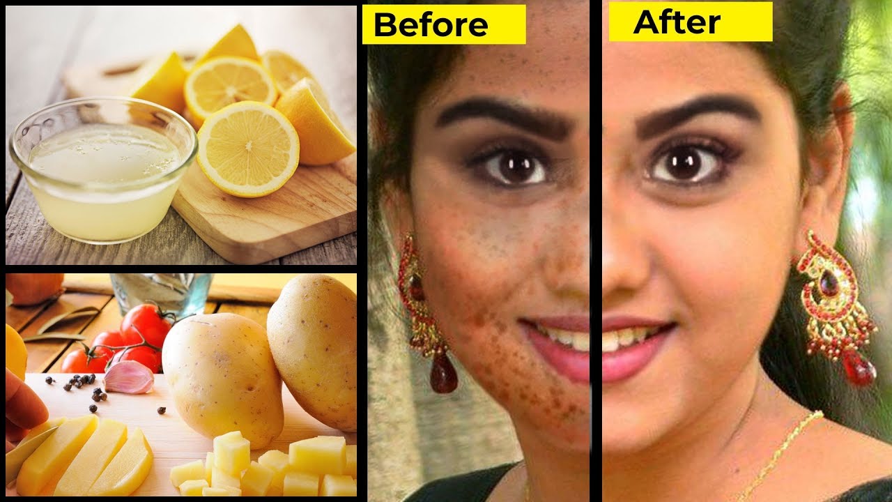 How to Remove Dark Spots in the Face Beauty Tips in Tamil