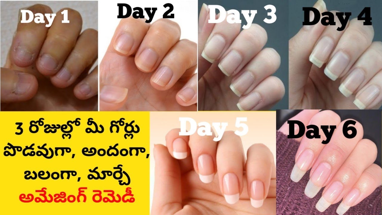 Grow Nails In Just 3 Days || Faster NailGrowth  Tips || How To Grow Nails Faster In One Day || 2021