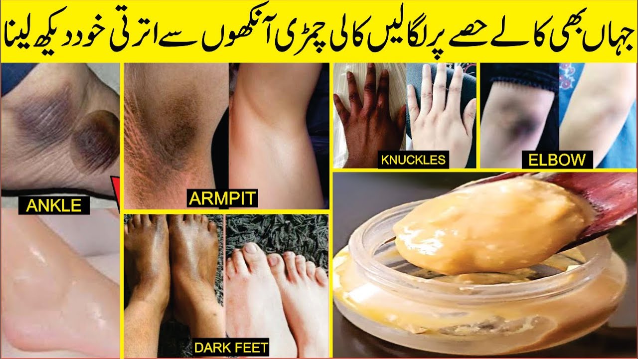 Skin Lightening (Like Bleach) At Home: Beauty Tips In Urdu: How To Lighten Dark Body Parts
